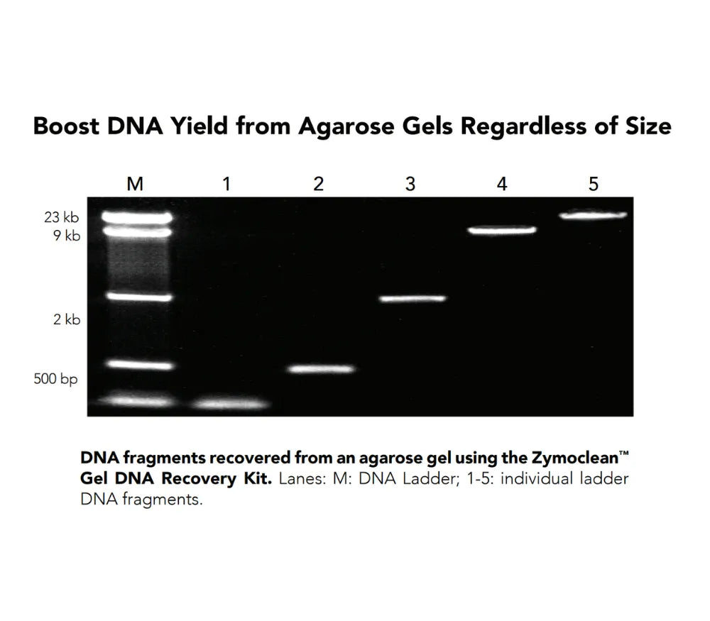 Zymoclean Gel DNA Recovery Kit Zymoclean Gel DNA Recovery Kit