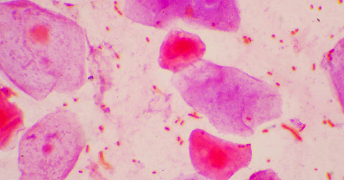 How to Extract RNA from Hard-to-Lyse Samples in Trizol<sup>®</sup>