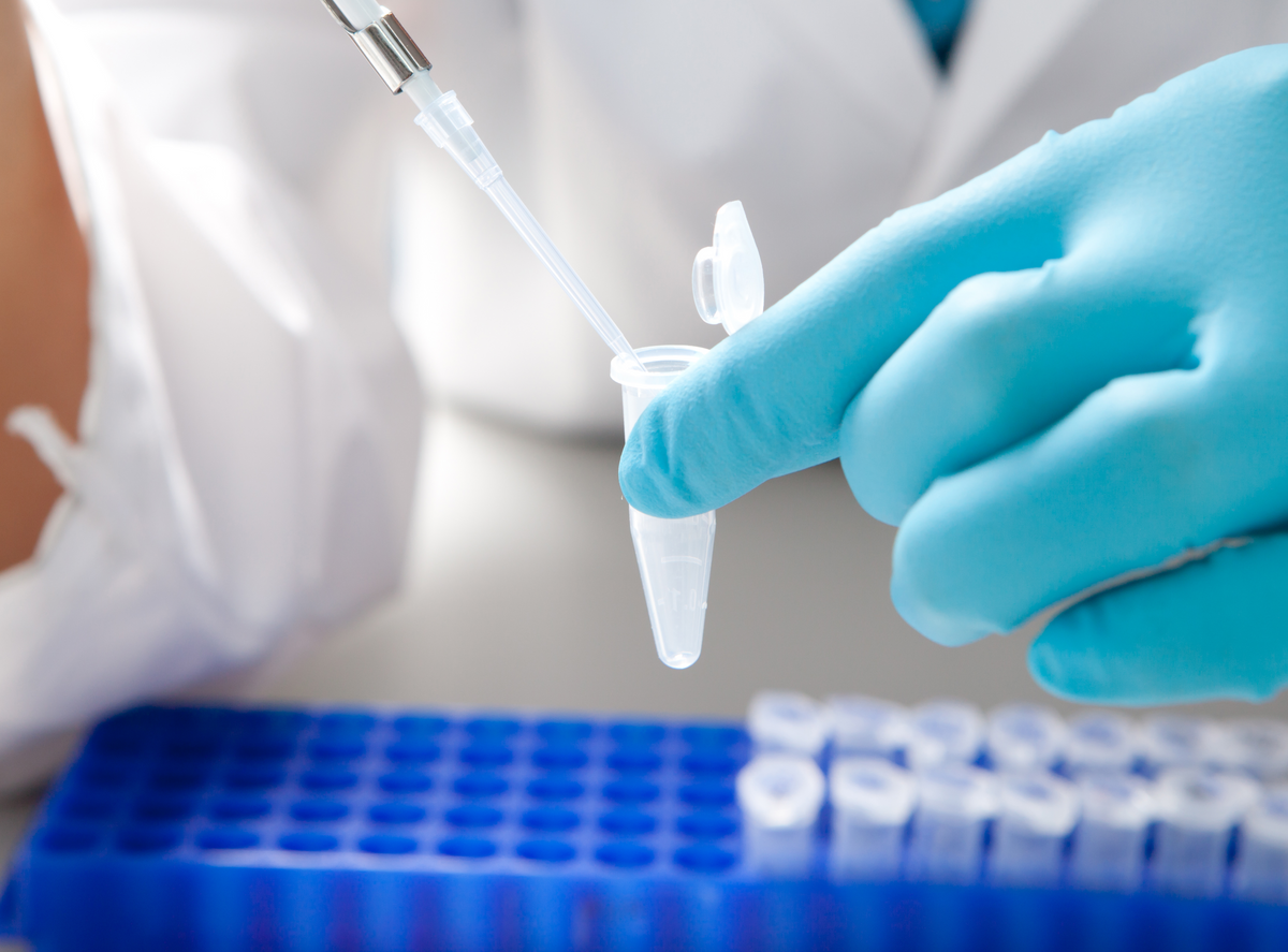 Tips & Tricks For RNA Isolation - RNA Extraction Troubleshooting