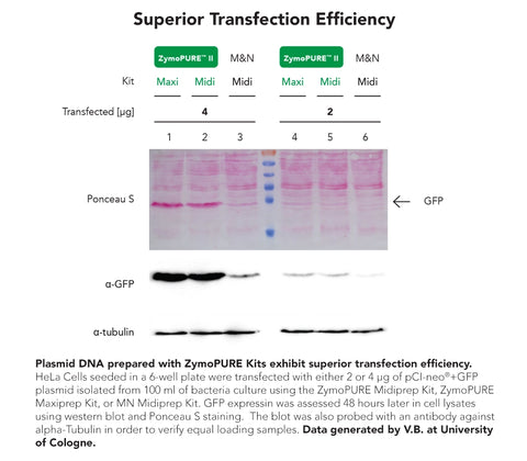 ZymoPURE II Plasmid Maxiprep Kit – Get a Free Sample Today